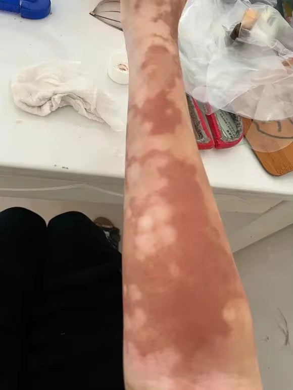 1. It starts with the reason the color disappeared.